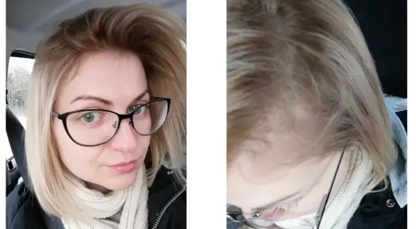 Jak wybrać farbę do ciemnego odrostu przy blondzie i uniknąć kontrastu